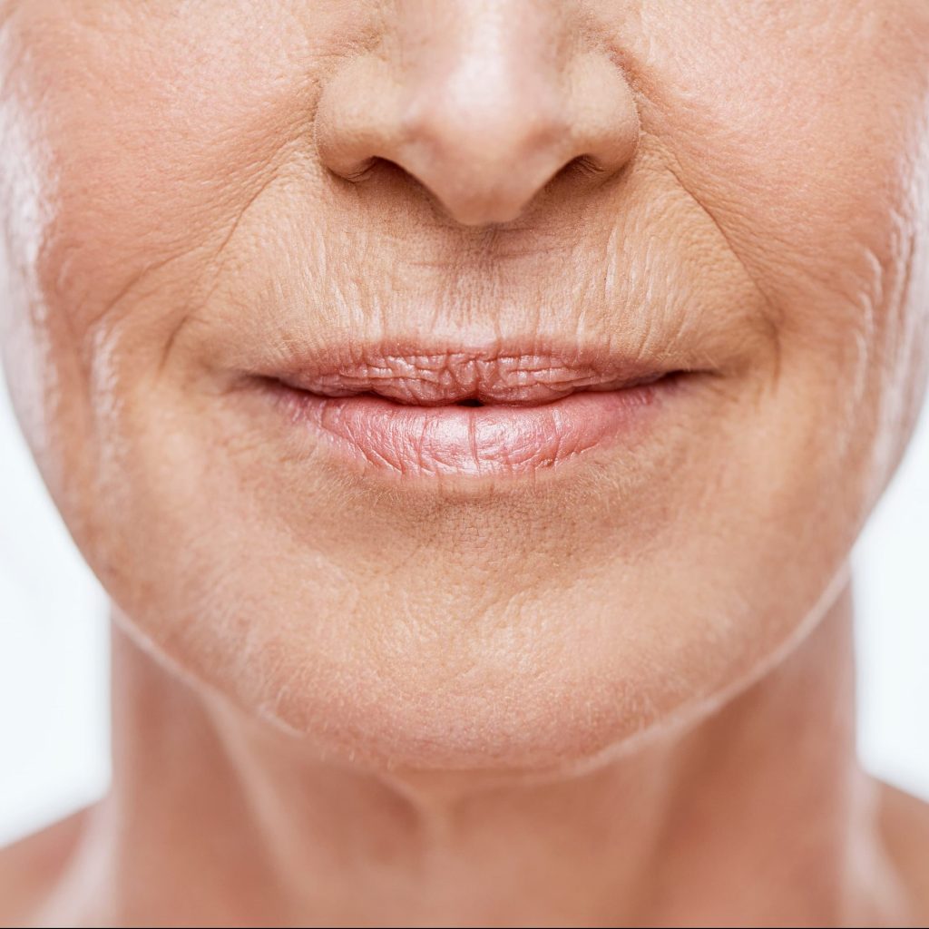 Woman with smoker's line above her lips